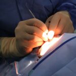 Más de 60 pacientes con obesidad mórbida se someten cada año a una cirugía bariátrica en el Hospital de Ciudad Real