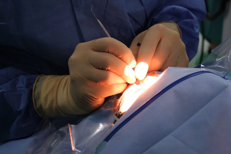 Más de 60 pacientes con obesidad mórbida se someten cada año a una cirugía bariátrica en el Hospital de Ciudad Real