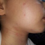 El CP ‘Fuente del Oro’ de Cuenca, afectado por la plaga de procesionaria