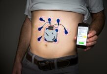 Diseñan un dispositivo portátil para controlar la actividad del estómago