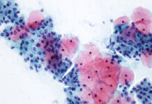 Nuevas alteraciones de la autofagia tras la lesión medular