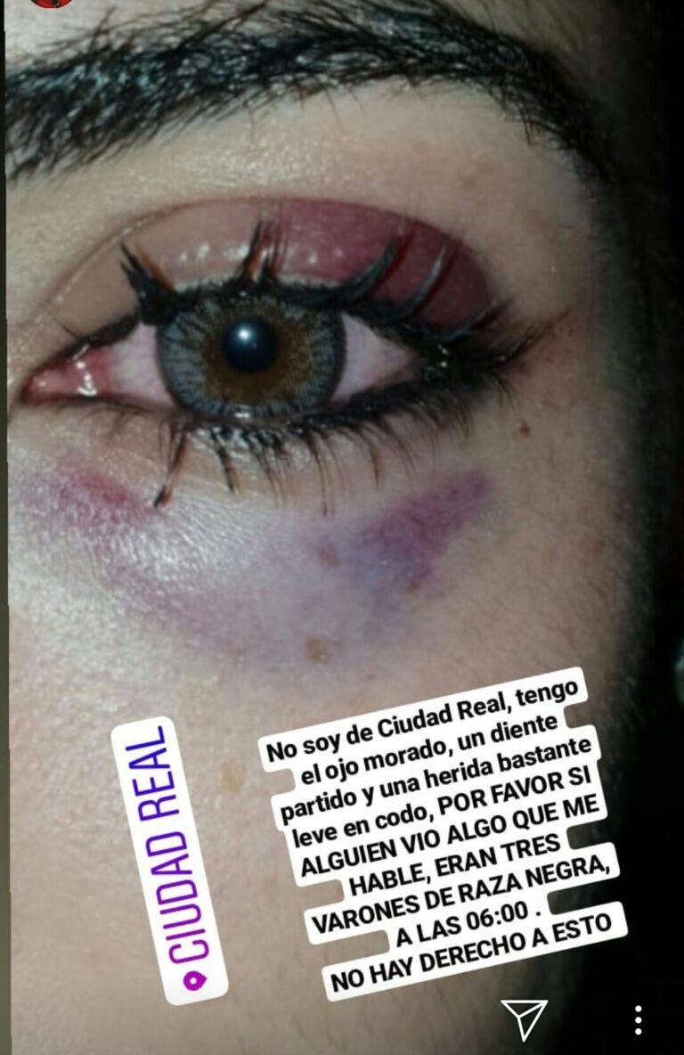 Nuevo intento de agresión sexual en Ciudad Real