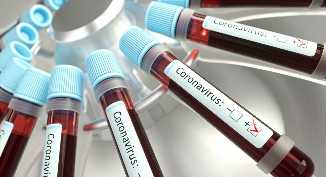 Coronavirus