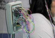 La Unidad de Epilepsia de Albacete podría contar con un proyecto de cirugía multidisciplinar