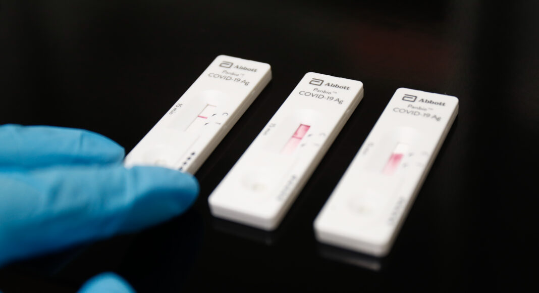 Test antígenos Coronavirus