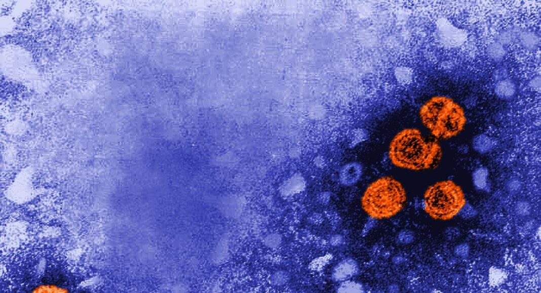 Viriones de la hepatitis B (de color naranja)