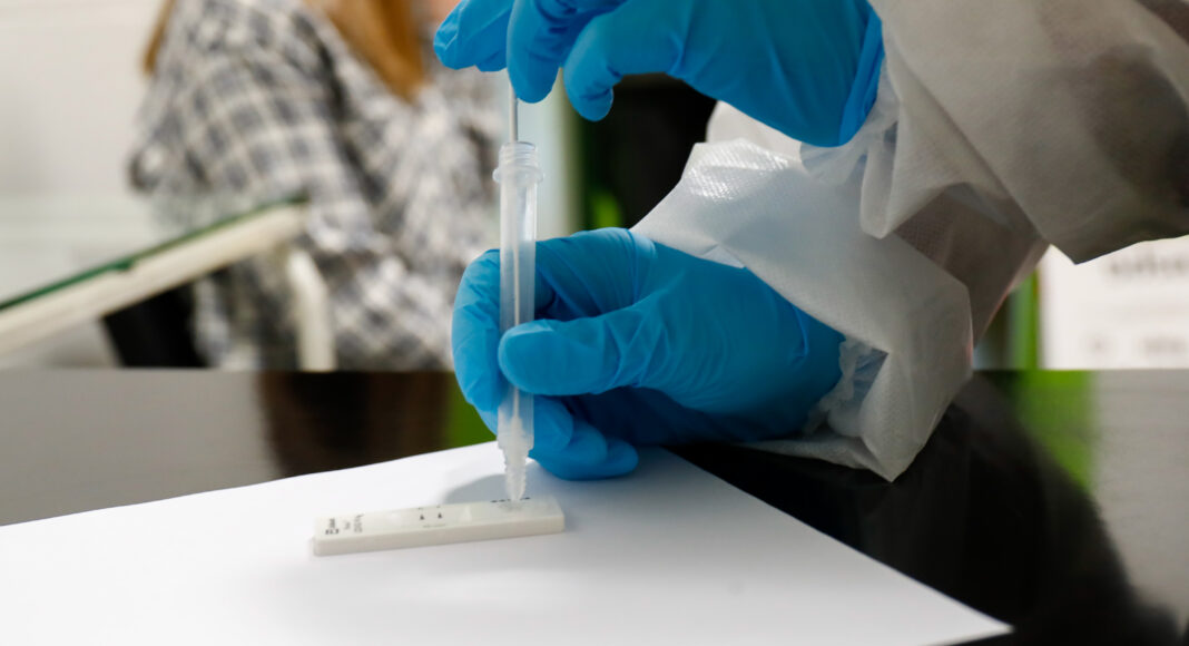 Test Antígenos Covid