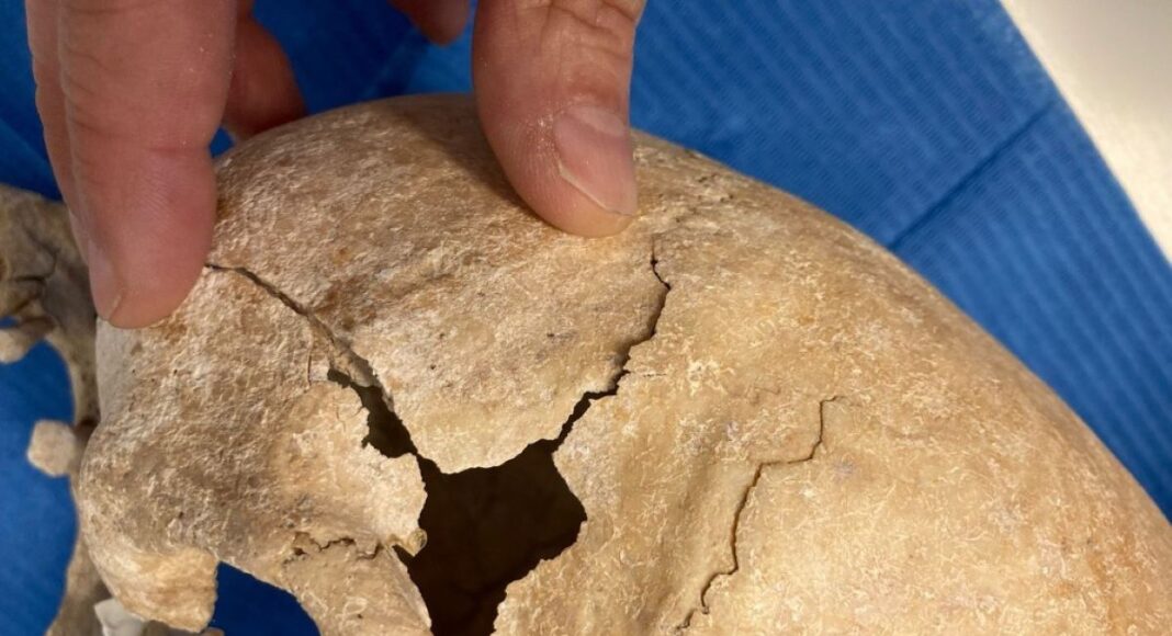 Craneo hallado en Guadalajara