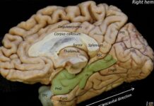 Un estudio en el que participa la UCLM avanza en el conocimiento de la enfermedad de Alzheimer y abre nuevas vías para su detección temprana