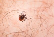 La Junta confirma un caso de fiebre hemorrágica Crimea-Congo en Toledo