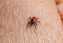 C-LM refuerza la vigilancia de enfermedades transmitidas por vectores tras el fallecido por mordedura de garrapata