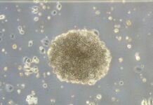 Una investigación en la que colabora la UCLM descubre un mecanismo de resistencia a un fármaco prometedor contra el cáncer