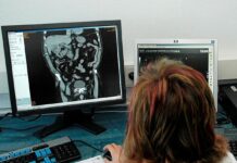 El Sescam invierte en IA para mejorar la Red de Imagen Digital